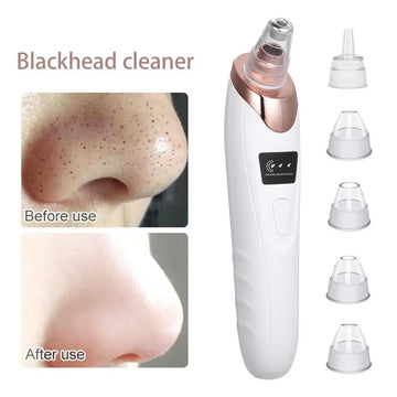Electric Blackhead Remover Vacuum Pore Cleaner