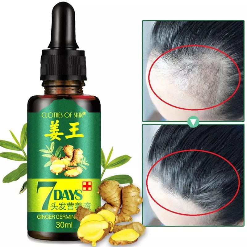 “7 Days Hair Growth Serum Oil – 30ML”