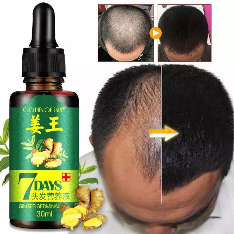 “7 Days Hair Growth Serum Oil – 30ML”